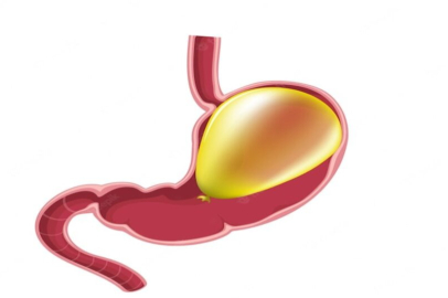 Mide Balonu Fiyatları